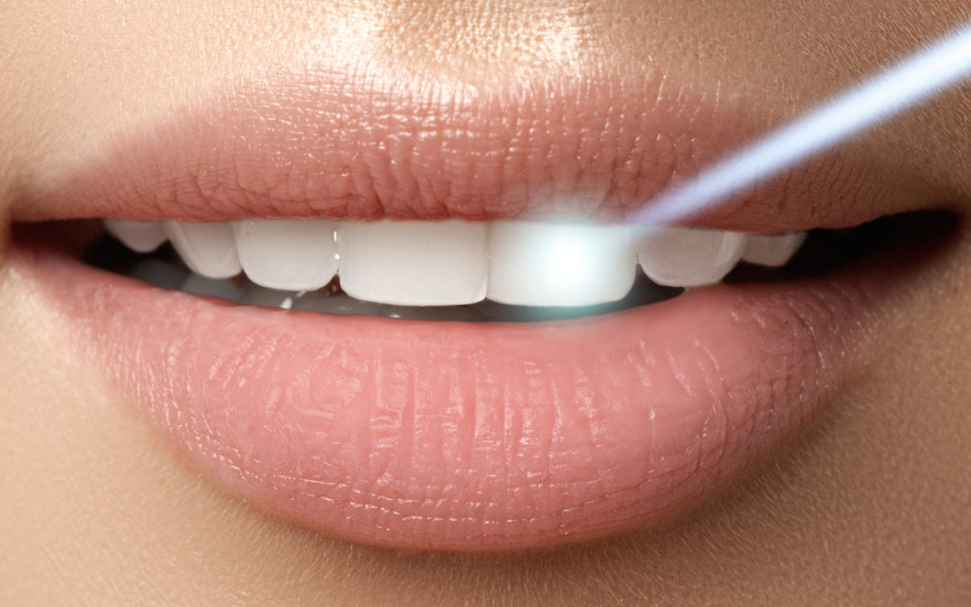 LaserTerapia