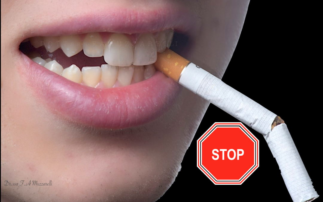 Il fumo fa male ai denti?